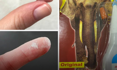 Gam gajah melekat pada jari selepas digunakan